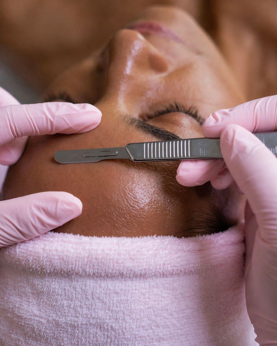 Aesthetician using a dermaplaning blade on a client's face