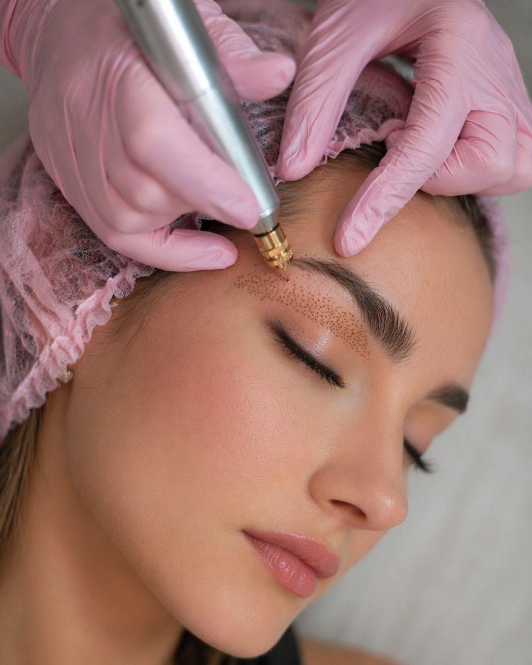 Plasma pen device being applied to a client's face